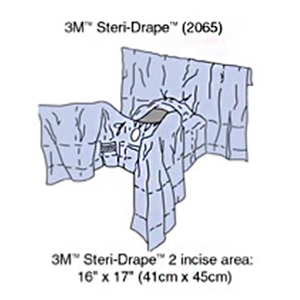 Steri-Drape™ Abdominal Perineal Drape with Incise Film, 160", Lithotomy Position, Absorbent Impervious Material, Incise Aperture, Perineal/ Vaginal Aperture, 4 Tube Organizer, 8/bx, 2 bx/cs