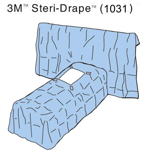 [MMM-1031] Abdominal Drape 3M™ Steri-Drape™ Supine Position Drape 90 W X 71 W X 112 L Inch Sterile