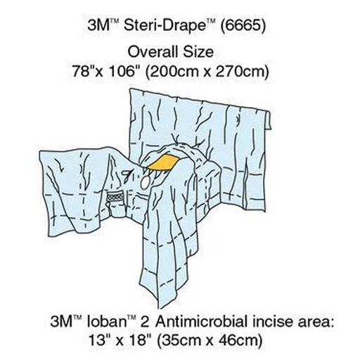[MMM-6665] Obstetrics / Gynecology Drape 3M™ Steri-Drape™ Abdominal-Perineal Lithotomy Position Drape 78 W X 106 L Inch Sterile